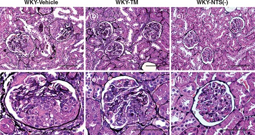 Light microscopy observations in the study groups. Representative images of sections stained with silver in a WKY-Vehicle rat (a, d), a WKY-TM rat (b, e) and a WKY-NTS (−) rat (c, f) on Day 7 are shown. The glomeruli on Day 7 show severe fibrinoid necrosis and cellular crescent formation (a, d). RH-TM treatment reduces glomerular hypertrophy, crescent formation and fibrinoid necrosis on Day 7 (b, e). Original magnifications, ×400 (a–c) and ×1000 (d–f). Scale bar, 100 μm (a–c) and 50 μm (d–f).
