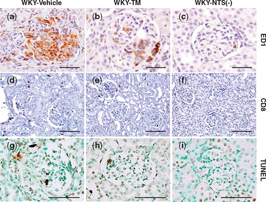 Immunohistochemical analysis of ED1, CD8 and TUNEL expression in the study groups. Representative pictures stained with immunohistochemistry for ED1 (a–c), CD8 (d–f) and TUNEL (g–i) of a WKY-Vehicle rat (a, d, g), a WKY-TM rat (b, e, h) and a WKY-NTS (−) rat (c, f, i) on Day 7 are shown. Original magnifications, ×1000 (a–c, j–i) and ×400 (d–f). Scale bar, 50 μm (a–c, j–i) and 100 μm (d–f).
