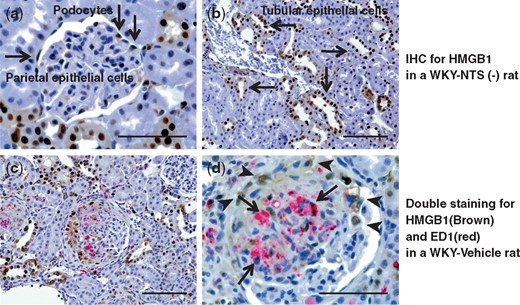 Immunohistochemical analysis of HMGB1 expression in the study groups. Representative images of sections immunohistochemically stained for HMGB1 in a WKY-NTS (−) rat (a, b) are shown. HMGB1 was stained in podocytes (a), parietal epithelial cells (a) and tubular epithelial cells (b) (arrows). Kidney sections were stained using two-color immunohistochemistry with ED1 stained red and HMGB1 stained brown in a WKY-Vehicle rat (c, d). Original magnifications, ×400 (b, c) and ×1000 (a, d). Scale bar, 50 μm (a, d) and 100 μm (b, c).