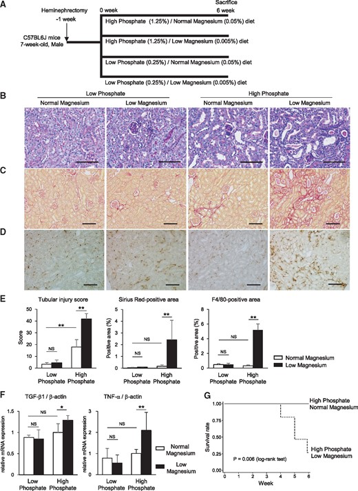 High phosphate diet–induced kidney injury is exacerbated by low magnesium feeding. (A) Heminephrectomized mice were administered either a high phosphate (1.25%)/normal magnesium (0.05%) diet (n = 6), a high phosphate (1.25%)/low magnesium (0.005%) diet (n = 15), a low phosphate (0.25%)/normal magnesium (0.05%) diet (n = 6) or a low phosphate (0.25%)/low magnesium (0.005%) diet (n = 6) for 6 weeks. (B–D) Representative micrographs showing (B) PAS-, (C) Sirius Red– and (D) F4/80-stained kidney sections. Scale bars: 100 µm for PAS staining, 200 µm for Sirius Red staining and F4/80 staining. (E) Tubular injury scores and Sirius Red– and F4/80-positive areas were significantly increased by the high phosphate/low magnesium diet. (F) TGF-β1 and TNF-α mRNA expression levels in the whole kidney were upregulated in the high phosphate/low magnesium diet group. (G) Kaplan–Meier curves showing the significantly reduced survival rate in mice maintained on the high phosphate/low magnesium diet compared with the high phosphate/normal magnesium diet (P = 0.006; log-rank test). At 6 weeks, all mice in the high phosphate/normal magnesium diet group (n = 6) were alive, whereas only 4 of 15 mice in the high phosphate/low magnesium diet group were alive. Data are presented as the mean ± standard deviation. Differences between the two groups were compared using a Student’s t-test with a Bonferroni correction (NS, not significant; *P<0.05, **P<0.01).