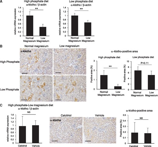 The low magnesium diet downregulates renal α-Klotho expression. (A) At 1 week after initiation of the high and low phosphate diets, the low magnesium diet significantly suppressed renal α-Klotho mRNA expression. (B) Representative immunohistochemical images for α-Klotho in the kidney (scale bar: 200 µm). The α-Klotho-positive areas were significantly reduced by the low magnesium diet under high phosphate feeding conditions and were nonsignificantly reduced under low phosphate feeding conditions. (C) Calcitriol administration did not restore the high phosphate/low magnesium diet–induced downregulation of α-Klotho. Data are presented as the mean ± standard deviation. Differences between the two groups were compared using a Student’s t-test. (n = 5–8 in each group; NS, not significant; **P<0.01).