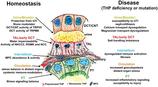 THP function in health and disease. This annotated drawing summarizes how THP is an important guardian of homeostasis (left side) both in the cells where it is produced (TALs and early DCTs) and also in target cells reached through the urine or via the interstitium and bloodstream. Disturbance in THP function either through deficiency or mutations can lead to disease by altering its function at various sites (right side). CNTs: connecting tubules; PTs: proximal tubules.
