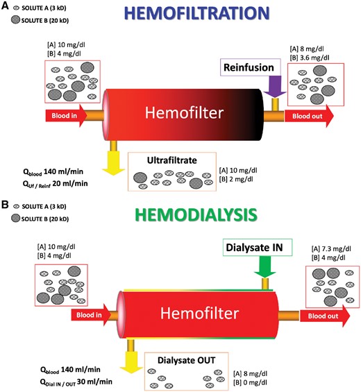 Schematic representation of mechanisms of solute transport during a purely convective treatment (haemofiltration) or during a purely diffusive treatment (haemodialysis). (A) During haemofiltration, if blood flow (Qblood) is set at 140 mL/min and plasma filtration fraction is 20%, ultrafiltration flow (QUf) will be 20 mL/min or 1200 mL/h, considering a haematocrit of 30%. When a re-infusion of 1200 mL/h (Qreinf) is delivered post-dilution, the clearance of the system will allow the removal of 1/5 of the small solute A since its sieving coefficient is 1. Clearance of solute B, whose molecular weight is close to standard haemofilters nominal cut-off, will be significantly lower than solute A, strictly depending on sieving coefficient and filter fouling. The colour gradient of the haemofilter represents the progressive haemoconcentration occurring inside the filter during (post-dilution) haemofiltration. (B) During haemodialysis, setting a similar Qblood, it will be possible to set dialysate flow (QdialIN) at 30 mL/min (1800 mL/h) since there is not a filtration fraction in this case. If this setting warrants a saturation of dialysate of 80%, then solute A will have a proportional concentration in the effluent but a slightly higher clearance compared with haemofiltration, considering the 50% increase in effluent flow. However, solute B will not be consistently removed during haemodialysis. In this case, there is no colour gradient inside the filter; however, a gradient occurs in countercurrent dialysate, flowing outside the hollow fibres, which is progressively saturated with waste solutes.