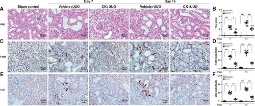 CK prevented renal TILs and mononuclear lymphocyte infiltration. Renal histopathological evaluation using (A) light microscopy, showing dilatation or atrophy of renal tubules, renal interstitial mononuclear leukocyte infiltration and fibrosis, and ischaemic collapse of the glomerular tufts with dilated Bowman’s space at Day 7 compared with sham control mice. These histopathological changes became relatively diffuse in distribution and more intense in severity in untreated mice at Day 14. (B) Scoring of TILs. IHC for (C and D) macrophages (F4/80) and (E and F) pan T cells (CD3). The quantitative results are reported as the number of (D) macrophages and (F) pan T cells in the renal tubulointerstitial compartment. Arrows indicate positive staining. H&E, hematoxylin and eosin. Original magnification was 400×. n = 7 mice per group. #Not detectable. *P < 0.05, ***P < 0.005.