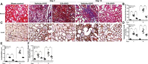 CK reduced renal fibrosis-related gene/protein expression. (A) Masson's trichrome. (B) Scoring of tubulointerstitial fibrotic area. White solid frame indicates positively stained renal tubulointerstitial fibrotic area. IHC for (C and D) Col-III. (D) Quantitative results reported as the positive area of Col-III in the tubulointerstitial compartment. Red solid frame indicates positively stained area. Original magnification was 400×. (E) Real-time PCR of renal mRNA levels of Col-III. (F) Total renal soluble collagen contents determined by ELISA. n = 7 mice per group. *P < 0.05, **P < 0.01, ***P < 0.005.
