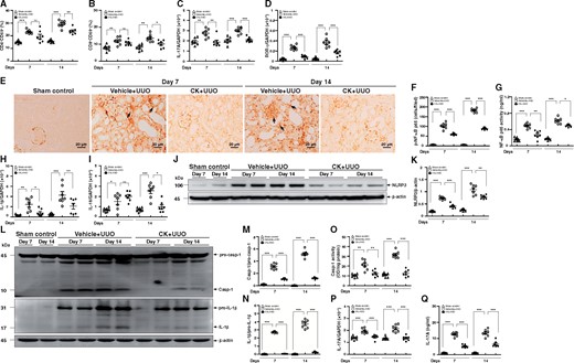 CK inhibited T cell activation in renal draining lymph nodes and NF-κB/NLRP3 inflammasome activation in renal tissues. Percentages of (A) CD4+CD69+ and (B) CD8+CD69+ cells determined by flow cytometry analysis, and real-time PCR of mRNA levels of (C) IL-17A and (D) ROR-γ in renal draining lymph nodes. IHC for (E and F) p-NF-κB p65. (F) Quantitative data as the number of p-NF-κB p65 cells in the tubulointerstitial compartment. Arrows indicate positive staining. Original magnification was 400×. (G) NF-κB p65 activity determined by an ELISA-based transcription factor activity assay. Real-time PCR of renal mRNA levels of (H) IL-1β and (I) IL-18. Western blot analysis for (J) NLRP3 and (K) semi-quantitative analysis, (L) caspase-1 and IL-1β, and semi-quantitative analysis of (M) caspase-1 and (N) IL-1β. (O) Caspase-1 activity determined by an enzyme activity assay. (P) Real-time PCR of renal mRNA levels of IL-17A. (Q) ELISA of renal protein levels of IL-17A. n = 7 mice per group. ns, no significant difference. *P < 0.05, **P < 0.01, ***P < 0.005.