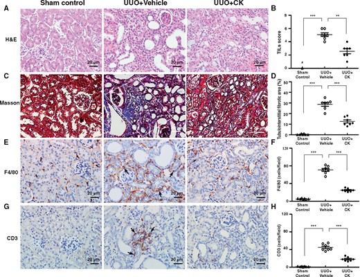 Therapeutic effects of CK on UUO mice. Renal histopathological evaluation using (A and B) hematoxylin and eosin (H&E) and (C and D) Masson’s trichrome staining. Scoring of (B) TILs and (D) renal tubulointerstitial fibrotic area. White solid frame indicates positively stained renal tubulointerstitial fibrotic area. IHC for (E and F) macrophages (F4/80) and (G and H) pan T cells (CD3). Quantitative results reported as the number of (F) macrophages and (H) pan T cells in the renal tubulointerstitial compartment. Arrows indicate positive staining. H&E, hematoxylin and eosin. Original magnification was 400×. n = 7 mice per group. #Not detectable. **P < 0.01, ***P < 0.005.