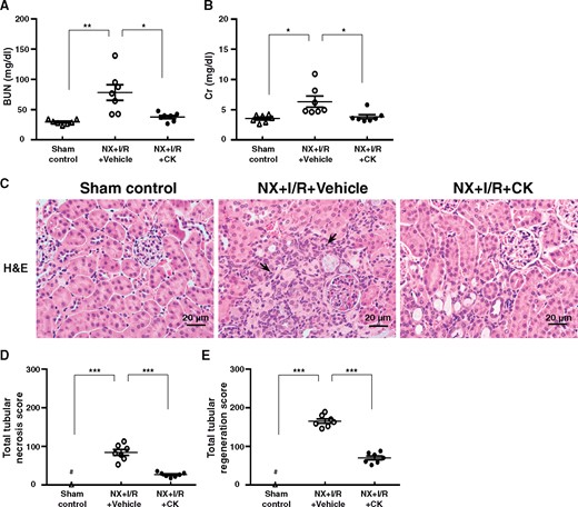 Therapeutic effects of CK on NX + I/R mice. Serum levels of (A) BUN and (B) Cr. Renal histopathological evaluation by (C) Light microscopy, showing tubular necrosis, tubular regeneration and mononuclear leukocyte infiltration. Scoring of (D) tubular necrosis and (E) tubular regeneration. Arrows indicate mononuclear leukocyte infiltration. Original magnification was 400×. NX + I/R, ischaemia–reperfusion injury with unilateral nephrectomy; H&E, hematoxylin and eosin. n = 7 mice per group. #Not detectable. *P < 0.05, **P < 0.01, ***P < 0.005.