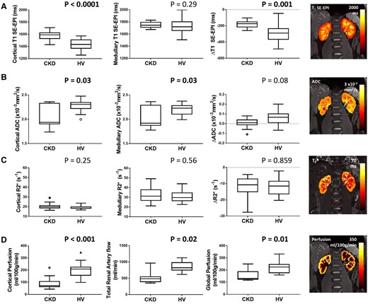 MRI parameters in the CKD and HV group for (A) SE-EPI T1 in cortex, medulla and CMD (ΔT1), (B) ADC in cortex, medulla and CMD (ΔADC), (C) R2* in cortex, medulla and CMD (ΔR2*), (D) cortical perfusion as measured by ASL, total renal artery flow and global perfusion (estimated from correcting renal artery flow for kidney volume). Significant differences are seen between the CKD and HV group for cortical T1 and ΔT1 (SE-EPI data shown here, with the correlation between SE-EPI and bFFE T1 measures shown in Supplementary data, Figure S2), cortical and medullary ADC, cortical perfusion, cortical and medullary ADC, total renal artery flow and global perfusion.