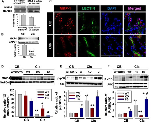 SIRT2 regulates cisplatin-induced downregulated MKP-1 expression in the kidney. (A) MKP-1 mRNA expression analysis in kidney of WT mice. Kidneys were harvested at embryo Day 15.5 and postnatal 8 weeks in WT mice. RT-PCR using kidney RNA to analyze the mRNA level of MKP-1 was carried out as described in the Materials and Methods section (n = 4, each group). (B) Western blot analyses of MKP-1 in the kidney of WT mice after cisplatin (Cis) treatment (n = 6, each group). (C) Fluorescent immunostaining of kidney sections with antibodies against MKP-1 and lectin to monitor the effects of Cis. CB or Cis-treated mouse kidneys were processed as described in our protocol. MKP-1 was detected with AlexaFluor 555-conjugated secondary antibody (red); nuclei were stained with DAPI (blue). Lectin (green) was used as a marker of proximal tubular epithelial cells. Bar = 100 μm. (D–F) Western blot analysis of MKP-1 (D), phosphorylation of p38 (E) and c-Jun N-terminal kinases (JNK; F) in the kidney of WT (n = 6), Sirt2 KO (n = 6) and Sirt2 TG (n = 6) mice. Kidneys were harvested 3 days after Cis (20 mg/kg body weight) or CB injection. Samples containing 20 µg of protein were subjected to electrophoresis and then analyzed by Western blot with antibody against MKP-1, GAPDH, phospho-p38 (p-p38), p38, phospho-JNK (p-JNK) and JNK. Relative protein level of MKP-1 was normalized to GAPDH. Relative protein levels of p-P38 and p-JNK were normalized to p38 and JNK, respectively. Data are expressed as mean ± SD. *P < 0.05 versus WT + CB; **P < 0.01 versus WT + CB; +P < 0.05 versus WT + Cis; ++ P < 0.01 versus WT + Cis; #P < 0.05 versus Sirt2 KO + Cis.