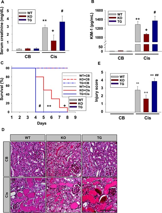 Effect of SIRT2 on kidney function, survival and renal injury. (A) Serum levels of creatinine. Blood samples from WT (n = 12), Sirt2 KO (n = 12) and Sirt2 TG (n = 12) mice were collected 3 days after Cis (20 mg/kg body weight) or CB injection and serum creatinine was measured. (B) Tissue level of KIM-1 in the kidney. Kidney samples from WT (n = 5), Sirt2 KO (n = 5) and Sirt2 TG (n = 5) mice were collected 3 days after Cis (20 mg/kg body weight) injection and kidney tissue level of KIM-1 was measured by ELISA. (C) Survival rate of WT (n = 10), Sirt2 KO (n = 10) and Sirt2 TG (n = 10) mice after Cis (20 mg/kg body weight) or CB administration. (D) Representative findings of periodic acid–Schiff staining of kidneys from WT, Sirt2 KO and Sirt2 TG mice treated with Cis or CB. Scale bar = 100 μm. (E) Injury score. Kidneys were harvested from WT (n = 6), Sirt2 KO (n = 6) and Sirt2 TG (n = 6) mice 3 days after Cis (20 mg/kg body weight) administration. Data are expressed as mean ± SD. **P < 0.01 versus WT + CB; +P < 0.05 versus WT + Cis; ++P < 0.01 versus WT + Cis; #P < 0.05 versus Sirt2 KO + Cis; ##P < 0.01 versus Sirt2 KO + Cis.