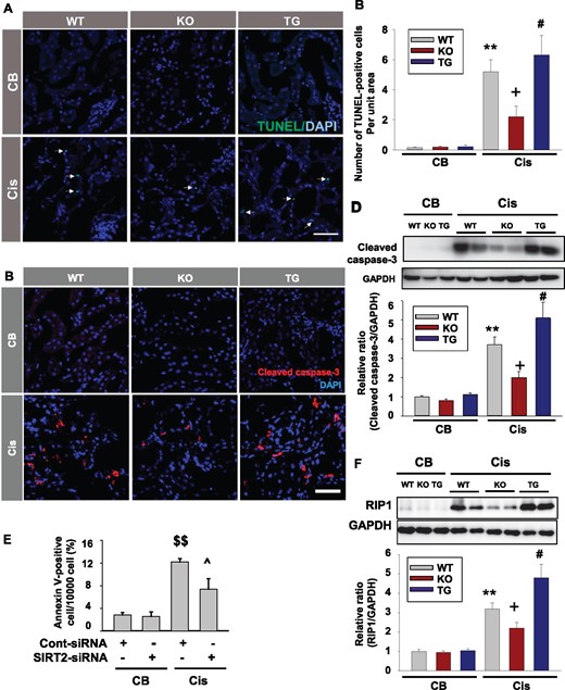 SIRT2 regulates cisplatin-induced tubular apoptosis and necroptosis. (A and B) Apoptosis was assessed by the terminal deoxynucleotidyl TUNEL assay and the number of apoptotic cells, as defined by chromatin condensation or nuclear fragmentation (apoptotic bodies), was counted. Scale bar = 100 µm. Kidneys in WT, Sirt2 KO and Sirt2 TG mice were harvested 3 days after cisplatin (Cis) or CB injection. TUNEL-positive cells were counted in 10 randomly, non-overlapping fields (×400 magnification) per kidney (n = 8, each group). The number of TUNEL-positive cells was significantly decreased in Sirt2 KO mice kidney and increased in Sirt2 TG mice kidney compared with WT mice. (C and D) Cleaved caspase-3 expression was evaluated by immunofluorescence (C) and Western blot analysis (D) using anti-caspase-3 (detecting cleaved forms) antibody. Kidneys in WT (n = 5), Sirt2 KO (n = 5) and Sirt2 TG (n = 5) mice were harvested 3 days after cisplatin administration. Densitometric analysis for cleaved caspase-3 is presented as the relative ratio of each cleaved caspase-3 to GAPDH. (E) Flow cytometry analyses of Annexin-V in small interfering RNA-targeting SIRT2 (SIRT2–siRNA) or control-siRNA (Cont-siRNA)-transfected MPT cells at 24 h after cisplatin (Cis; 20 mg/mL) treatment (n = 4, each group). (F) Western blot analysis of RIP-1. Kidneys in WT (n = 5), Sirt2 TG (n = 5) and Sirt2 KO (n = 5) mice were harvested 3 days after cisplatin administration. Data are expressed as mean ± SD. **P < 0.01 versus WT + CB; +P < 0.01 versus WT + Cis; #P < 0.05 versus WT + Cis; $$P < 0.05 versus CB + Cont-siRNA; ^P < 0.05 versus Cis + Cont-siRNA.