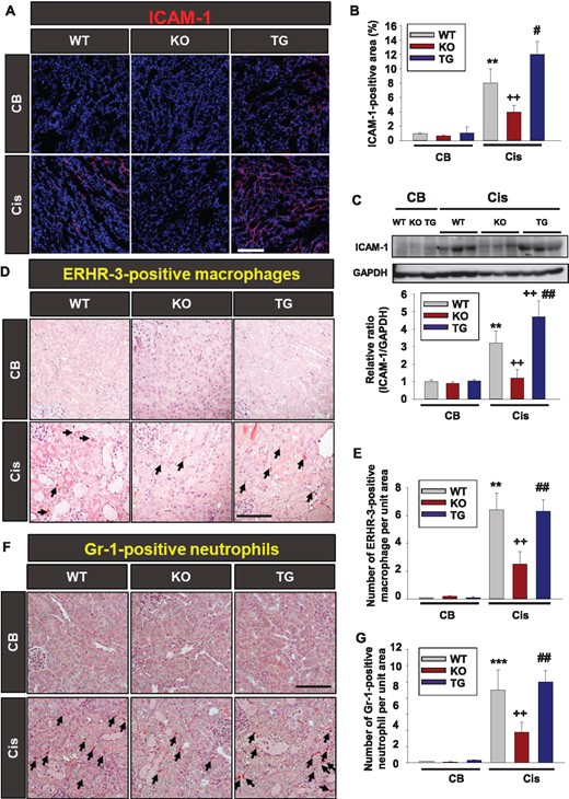 SIRT2 regulates cisplatin-induced renal inflammation. (A) Immunofluorescence study of ICAM-1. Kidneys from WT (n = 8), Sirt2 KO (n = 8) and Sirt2 TG (n = 8) mice were harvested at 3 days after intraperitoneal cisplatin (Cis) or CB injection. Tissues were fixed in 4% formaldehyde solution and kidney sections were then stained with ICAM-1 antibody. Scale bar = 100 μm. (B) Quantitative score of ICAM-1-positive area in the kidney section. (C) Western blot analysis of ICAM-1 in the kidney tissue from WT (n = 8), Sirt2 KO (n = 8) and Sirt2 TG (n = 8) mice treated with Cis or CB. Densitometric analyses are presented as the relative ratio of ICAM-1 to GAPDH. Note that the expression of ICAM-1 was significantly decreased in Sirt2 KO mice kidneys and increased in Sirt2 TG mice compared with WT mice kidneys. Data are expressed as mean ± SD. (D) Immunohistochemical findings of ERHR-3-positive macrophage. Kidneys from WT (n = 8), Sirt2 KO (n = 8) and Sirt2 TG (n = 8) mice were harvested at 3 days after intraperitoneal Cis or CB injection. Tissues were fixed in 4% formaldehyde solution and kidney sections were then stained with ERHR-3 antibody. Scale bar = 100 μm. (E) Quantitative score of ERHR-3-positive macrophages in the kidney section. (F) Immunohistochemical study of Gr-1-positive neutrophil. Kidneys from WT (n = 8), Sirt2 KO (n = 8) and Sirt2 TG (n = 8) mice were harvested at 3 days after intraperitoneal Cis or CB injection. (G) Quantitative score of Gr-1-positive neutrophils in the kidney section (G). Data are expressed as mean ± SD. **P < 0.01 versus WT + CB; ***P < 0.001 versus WT + CB; ++P < 0.01 versus WT + Cis; #P < 0.05 versus Sirt2 KO + Cis; ##P < 0.01 versus Sirt2 KO + Cis.