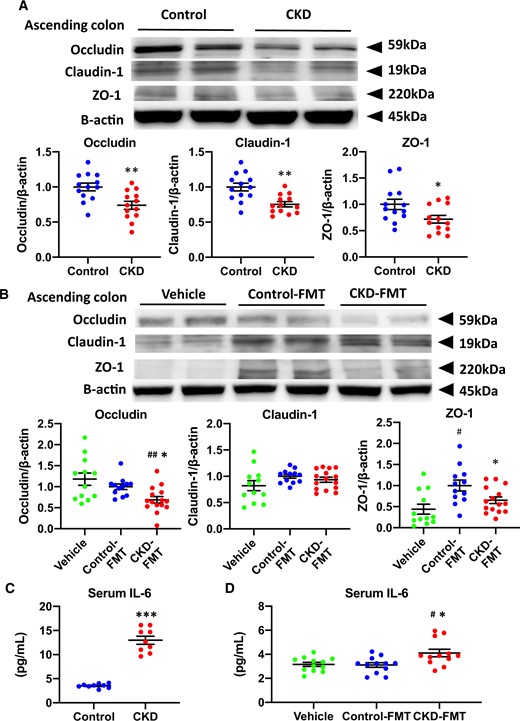 Disruption of intestinal barrier and systemic microinflammation in CKD mice and CKD-FMT mice. Expression levels of the tight junction proteins occludin, claudin-1 and ZO-1 in (A) the ascending colon of control mice (blue dots) and CKD mice (red dots), as well as (B) those of vehicle mice (green dots), control-FMT mice (blue dots) and CKD-FMT mice (red dots) (n = 12–13 per group). The blots for β-actin are shown as loading controls. The representative results for three independent experiments are shown. Serum IL-6 concentration in (C) control mice and CKD mice (n = 10 per group) as well as (D) vehicle mice, control-FMT mice and CKD-FMT mice (n = 12 per group). #P < 0.05, ##P < 0.01, ###P < 0.001 versus vehicle mice. *P < 0.05, **P < 0.01, ***P < 0.001 versus control mice or control-FMT group. Bar represents mean ± standard error of the mean.