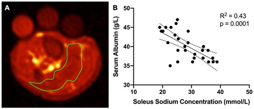 Figure: Panel A: sample 23Na MRI image with soleus muscle region of interest (in green). Panel B: linear regression fit of soleus sodium concentration vs serum albumin (95% confidence interval bands).