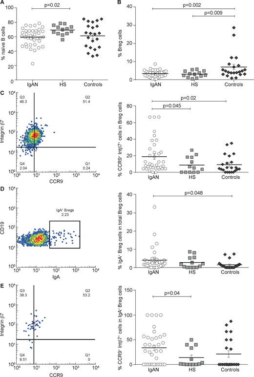 Bregs subset analysis in IgAN patients compared with HSs and controls. PBMCs were isolated from 36 IgAN patients, 13 HSs and 22 non-IgA glomerulonephritis patients (controls) and the naïve B cells subpopulation was analysed by flow cytometry. (A) The naïve B cells were lower in IgAN patients and in non-IgA glomerulonephritis controls compared with HSs. (B) Total Breg subpopulation was analysed in IgAN patients, HSs and controls. There was no significant difference between IgAN patients and HSs. Instead, total Bregs frequency was higher in controls compared with IgAN patients (P = 0.002) and HSs (P = 0.009). (C) Gut-homing (CCR9+ integrin β7+) Breg frequencies in IgAN patients, HSs and controls. Gut-homing Breg cells were increased in IgAN patients compared with HSs and controls (P = 0.045 and P = 00.02, respectively). (D) IgA+ Bregs frequencies in IgAN patients, HSs and controls. IgA+ Bregs were increased in IgAN patients compared with controls (P = 0.048). (E) Gut-homing (CCR9+ integrin β7+) IgA+ Bregs frequencies in IgAN, HSs and controls. Gut-homing IgA+ Bregs were higher in IgAN patients compared with HSs and controls (P = 00.04). One-way ANOVA test was used to compare groups.