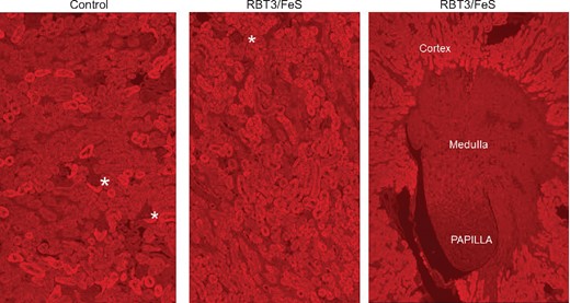 RBT-3 induces prominent increases in HO-1 expression in mouse proximal tubules, as assessed by immunohistochemistry. The control kidney, shown in the left-hand panel, demonstrates variable cytoplasmic staining of proximal tubule segments within the renal cortex. In contrast, the kidney harvested 18 h post-RBT-3 injection (middle panel) showed a prominent and near-confluent proximal tubule HO-1 increase. In contrast, no obvious increase in HO-1 staining was apparent in the glomeruli (depicted by the asterisks) or medullary papillary regions (right-hand panel). Thus these findings confirmed that the HO-1 mRNA changes depicted in Figure 5 were reflected by increased renal HO-1 protein levels and that these increases reflected HO-1 increases predominantly within cortical proximal tubules.