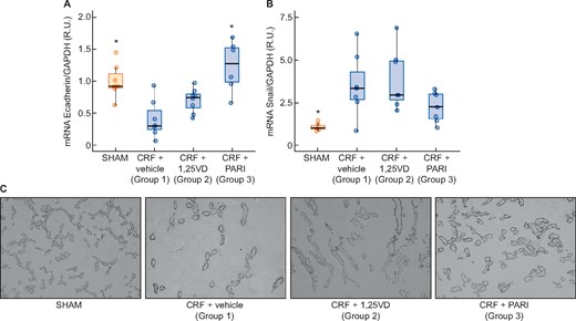 Immunohistochemistry renal EMT: E-cadherin immunohistochemistry and E-cadherin and Snail expression evaluated by qPCR. SHAM-operated (SHAM); CRF rats + vehicle (CRF + vehicle, Group 1), CRF rats + calcitriol (CRF + 1,25VD, Group 2), CRF rats + paricalcitol (CRF + PARI, Group 3). (A) E-cadherin mRNA. (B) Snail mRNA. (C) Representative photo of E-cadherin immunohistochemistry 10×. Data represent median and interquartile range. *P < 0.05 versus CRF + vehicle.