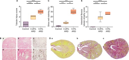 Renal histological evaluation of rats fed a 0.25 and 0.5% ARD and controls (Ctrl). (A) Tubular injury score after haematoxylin–eosin staining. (B) Renal histology in optical microscopy after haematoxylin–eosin staining in (a and d) control rats, (b and e) 0.25% ARD rats and (c and f) 0.5% ARD rats: (a–c) magnification ×20, (d–f) magnification ×100. (C) Sirius red staining. (D) Renal histology in optical microscopy after Sirius red staining on full histological section in (a) control rats, (b) 0.25% ARD rats and (c) 0.5% ARD rats. (E) IF/tubular injury score. *P < 0.05, **P < 0.01, ***P < 0.001, ****P < 0.0001.