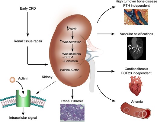 Schematic overview of the effects of ActA systemic activation on the organ involved CKD-MBD.