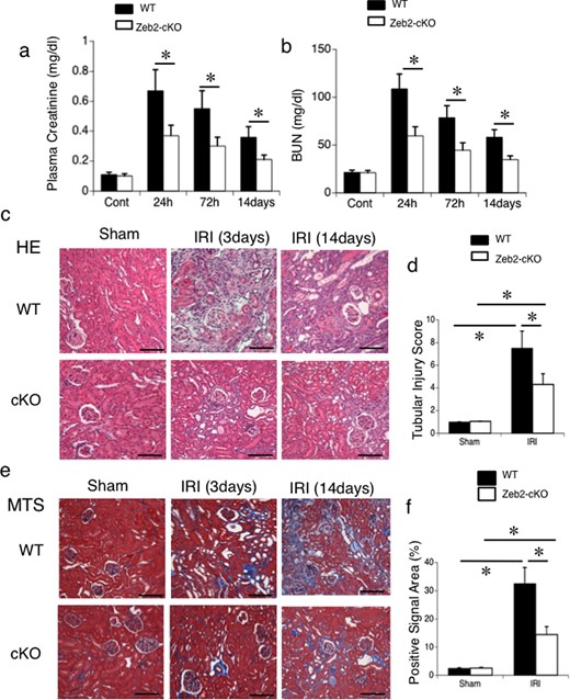 Zeb2-cKO mice are protected against renal IRI. (a) Plasma creatinine and (b) BUN levels were measured as indicators of kidney function in mice exposed to sham operation or IRI (ischemia followed by 24 h, 72 h or 14 days reperfusion). (c) Representative morphology (revealed by hematoxylin–eosin staining) of the kidneys from WT and Zeb2-cKO mice after sham operation or IRI. (d) Semiquantitative assessment of tubular injury in WT and Zeb2-cKO mice at 14 days after sham operation or IRI. (e) Representative morphology (revealed by Masson's trichrome staining) of the kidneys from WT and Zeb2-cKO mice after sham operation or IRI. (f) Semiquantitative assessment of fibrotic changes (positive staining with Masson's trichrome staining) in WT and Zeb2-cKO mice at 14 days after sham operation or IRI. Values represent the mean ± SEM of evaluation from each group (n = 6/group). *P < 0.05. Scale bars = 50 μm.
