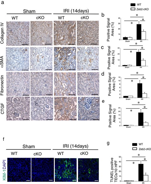 Immunohistochemical analysis of fibrosis markers and KIM-1 in mouse kidneys after IRI. (a) Immunohistochemical analysis of the fibrosis markers, such as collagen type IV, α-SMA, fibronectin and CTGF, in the renal cortex from WT and Zeb2-cKO sham-operated and IRI mice. (b–e) Quantitative assessment of collagen type IV-positive area (b), α-SMA-positive area (c), fibronectin-positive area (d) and CTGF-positive area (e) in WT and Zeb2-cKO mice at 14 days after sham operation or IRI. (f) Immunohistochemical analysis of KIM-1 in the renal cortex from WT and Zeb2-cKO mice at 14 days after sham and IRI mice. (g) Quantitative assessment of KIM-1-positive cells in WT and Zeb2-cKO mice at 14 days after sham operation or IRI. Values represent the mean ± SEM of each group (n = 6/group). *P < 0.05. Scale bars = 50 μm.