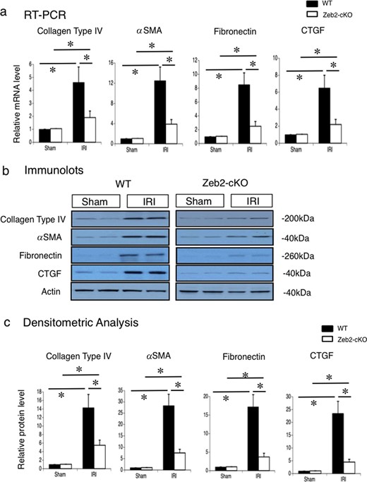 Collagen type IV, α-SMA, fibronectin and CTGF mRNA expression and protein levels in mouse kidneys after IRI. (a) Gene expression of collagen type IV, α-SMA, fibronectin and CTGF in the kidneys, examined using real-time PCR, at 14 days after IRI or sham operation (control) in WT and Zeb2-cKO mice. The expression levels of these genes were normalized to that of 18S rRNA, and they are presented as values relative to the respective expression levels in WT sham-operated kidney. (b) Protein expression of collagen type IV, α-SMA, fibronectin and CTGF in the kidneys, examined through western blotting, at 14 days after IRI or sham operation (control) in WT and Zeb2-cKO mice. (c) Quantitative analysis of collagen type IV, α-SMA, fibronectin and CTGF protein expression. The expression levels were normalized to that of β-actin, and they are presented as values relative to the respective expression levels in WT sham-operated kidney. Data are shown as mean ± SEM, n = 6. *P < 0.05.