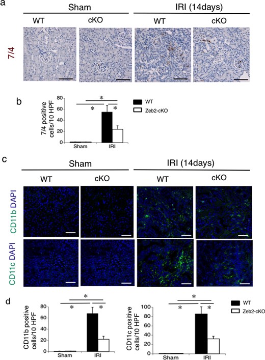 Immunohistochemical analysis of infiltration of neutrophils, macrophages and dendritic cells in mouse kidneys after IRI. (a) Immunohistochemical analysis of the neutrophil marker (7/4 antibody-positive) in the renal cortex from WT and Zeb2-cKO sham-operated and IRI mice. (b) Quantitative assessment of the neutrophil marker (7/4 antibody-positive)-positive cells in WT and Zeb2-cKO mice at 14 days after sham operation or IRI. (c) Immunohistochemical analysis of macrophages (CD11b-positive) and dendritic cells (CD11c-positive), in the renal cortex from WT and Zeb2-cKO sham-operated and IRI mice. (d) Quantitative assessment of macrophages (CD11b-positive) and dendritic cells (CD11c-positive) in WT and Zeb2-cKO mice at 14 days after sham operation or IRI. Values represent the mean ± SEM of each group (n = 6/group). *P < 0.05. Scale bars = 50 μm.