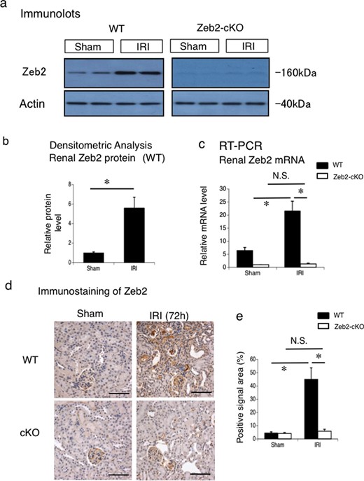 Zeb2 mRNA and protein expression in IRI-induced AKI. (a) Protein expression of Zeb2 in the mouse kidneys, examined using western blotting, at 72 h after IRI or sham operation (control) in WT and Zeb2-cKO mice. (b) Quantitative analysis of Zeb2 protein expression after IRI or sham operation (control) in WT mice. The expression levels were normalized to that of β-actin and are presented as values relative to that in sham-operated kidney. (c) mRNA expression of Zeb2 in mouse kidneys, examined using real-time PCR, at 72 h after IRI or sham operation (control) in WT mice. The expression levels were normalized to that of 18S rRNA and are presented as values relative to that of Zeb2-cKO sham-operated kidney. (d) Immunohistochemical staining of Zeb2 expression in the renal cortex of WT and Zeb2-cKO mice after sham operation and IRI. (e) Quantitative assessment of Zeb2-positive area in WT and Zeb2-cKO mice at 72 h after sham operation or IRI. Data are presented as mean ± SEM, n = 6. *P < 0.05, N.S., not significant. Scale bars = 50 μm.