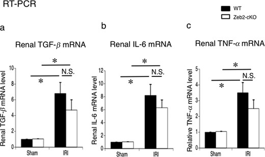 Expression of TGF-β, IL-6 and TNF-α in the mouse kidneys after sham operation (control) and IRI. (a–c) mRNA expression of TGF-β, IL-6 and TNF-α in the kidneys, examined using real-time PCR, at 24 h after IRI or sham operation (control) in WT and Zeb2-cKO mice. The expression levels were normalized to that of 18S rRNA and are presented as values relative to respective expression levels in control. Data are shown as mean ± SEM, n = 6. *P < 0.05, N.S., not significant.