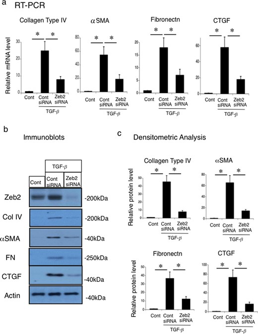Zeb2 siRNA reduces the TGF-β-stimulated collagen type IV, α-SMA, fibronectin and CTGF expression in mouse renal tubular epithelial (MCT) cell line. MCT cells were transfected with Zeb2 siRNA or control siRNA. At 24 h after transfection, cells were either not treated (control) or stimulated with 50 ng TGF-β for 12 h. (a) mRNA expression of collagen type IV, α-SMA, fibronectin and CTGF were examined using RT-PCR. The expression levels were normalized to that of 18S rRNA and are presented as values relative to the respective expression levels in control. (b) Protein expression of Zeb2, collagen type IV, α-SMA, fibronectin and CTGF were examined using immunoblotting. (c) Quantitative analysis of collagen type IV, α-SMA, fibronectin and CTGF protein expression. The expression levels were normalized to that of β-actin and are presented as values relative to the respective expression levels under control condition. Data are presented as mean ± SEM, n = 6. *P < 0.05 versus control.