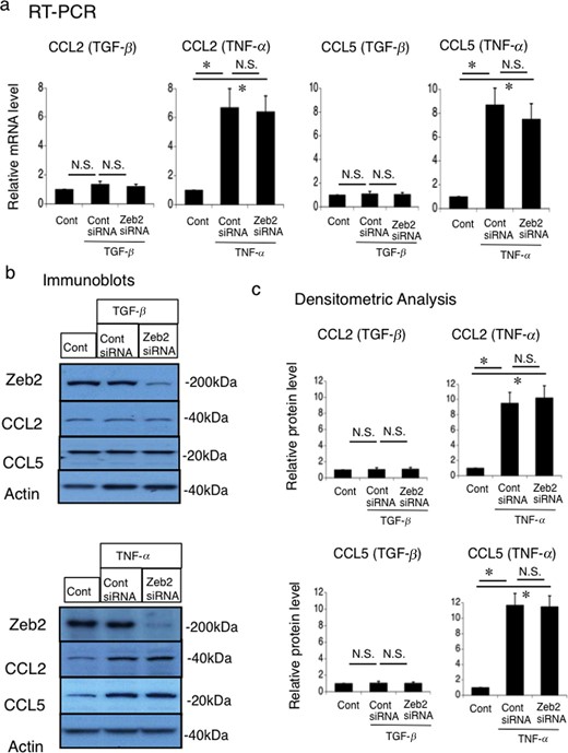 Effects of Zeb2 siRNA on the TGF-β-stimulated and TNF-α-stimulated CCL2 and CCL5 expression in mouse renal tubular epithelial (MCT) cell line. MCT cells were transfected with Zeb2 siRNA or control siRNA. At 24 h after transfection, cells were either not treated (control) or stimulated with 50 ng/mL TGF-β or 10 ng/mL TNF-α for 24 h. (a) mRNA expression of CCL2 and CCL5 was evaluated using RT-PCR. The expression levels were normalized to that of 18S rRNA and are presented as values relative to the respective expression levels in the control. (b) Protein expression of Zeb2, CCL2 and CCL5 was examined using immunoblotting. (c) Quantitative analysis of CCL2 and CCL5 protein expression. The expression levels were normalized to that of β-actin and are presented as values relative to the respective expression levels under control condition. Data are presented as mean ± SEM, n = 6. *P < 0.05 versus control, N.S., not significant.
