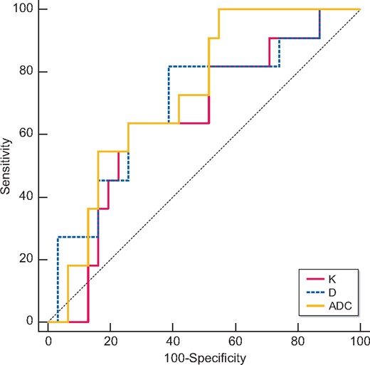 Validity of K, D and ADC in discriminating the renal outcome between with and without eGFR loss of ˃30%. Excellent discrimination existed for ADC. Regarding the pairwise comparison of ROC curves, the AUC of ADC was larger than those of K and D. There were no significant differences among K, D and ADC.