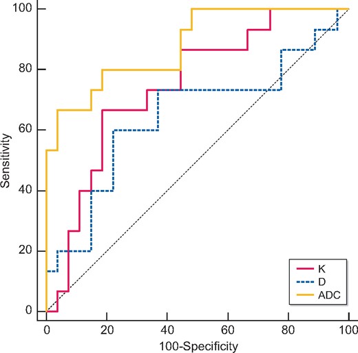Validity of K, D and ADC in discriminating the renal outcome between with and without the composite endpoint (ESRD or eGFR loss of ˃30%). Excellent discrimination existed for K and ADC. Regarding the pairwise comparison of ROC curves, there were significant differences between K and ADC (P = 0.0417) and between D and ADC (P = 0.0126).