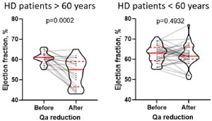 Changes in ejection fraction as a result of Qa reduction in HD patients >60 and <60 years old.