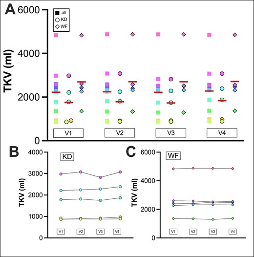 TKV of patients was monitored at all visits (V1–V4). TKV is shown for (A) all patients, (B) the KD group and (C) the WF group. Red line indicates mean. V2 to V3: interval from start to end of KDIs. All: ΔTKV V1 to V2: +0.75%, SEM: 0.52%, ΔTKV V2 to V3: −1.06%, SEM 1.1%, ΔTKV V3 to V4: +3.28%, SEM 1.13%, TKV V2 to V3 P = .3765. KD: ΔTKV V1 to V2: +1.47%: SEM: 0.69%, ΔTKV V2 to V3: −1.88%, SEM: 1.87%, ΔTKV V3 to V4: +5.54%, SEM: 1.25%, TKV V2 to V3 P = .3605. WF: ΔTKV V1 to V2: +0.03%, SEM: 0.69%, ΔTKV V2 to V3: −0.23%, SEM: 1.28%, ΔTKV V3 to V4: +1.02%, SEM: 1.30%, TKV V2 to V3 P = .9893. SEM: standard error of the mean.