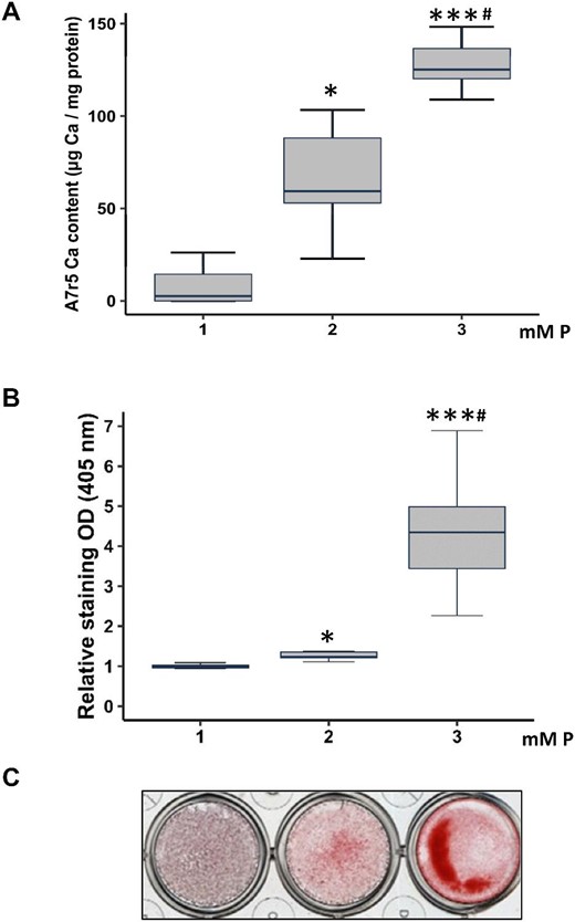 Effects of P (from 1 to 3 mM P) on Ca content in A7r5 cells cultured for 3 days in vitro (Phase 4). DMEM 1 mM P is considered non calcifying media (Non-CM), and 2 and 3 mM are considered calcifying media (CM). Ca deposition determined by o-cresolphtalein complexone method (A) and Alizarin red staining (B) with a representative image of Alizarin red staining (C). Data represent median (IQR). *P < .05, ***P < .001 versus 1 mM P; #P < .05 versus 2 mM P.