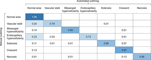 CNN confusion matrix per pixel assessing glomerular lesions within regions of interest in the Test cohort. For example, for pixels having been manually assigned to the mesangial hypercellularity category, the neural network correctly predicted the category for 85% of those pixels.