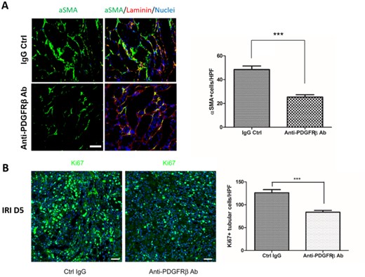Anti-PDGFRβ Ab inhibited pericyte–myofibroblast transition and tubular regeneration after IRI. (A) Representative images showed aSMA+ cells of the kidneys at day 5 after IRI with or without anti-PDGFRβ antibody administration. Bar chart showed the numbers of aSMA+ cells. (B) Representative images showed Ki67+ cells of the kidneys at day 5 after IRI with or without anti-PDGFRβ antibody administration. Bar chart showed the numbers of Ki67+ cells. Scale bar, 50 μm. Original magnification × 200. n = 5 for each group. Data were expressed as the mean ± SEM. *P < 0.05, **P < 0.01, ***P < 0.001 by Student's t-test.