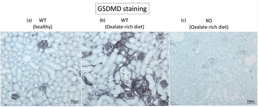 GSDMD staining of WT (healthy control), WT (Oxalate-rich diet), and KO (Oxalate-rich diet) (a) GSDMD is positive in some interstitial cells, endothelial cells, and glomerular cells, but not in tubular cells (b) Injured tubular cells also seem to express GSDMD (c) Despite the lack of GSDMD, it shows more severe kidney injury.