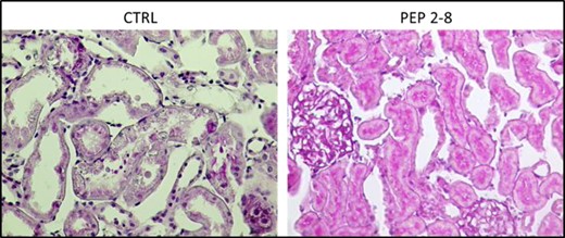 Representative histology sections from control group (CTRL) and treated (PEP 2-8) kidneys.