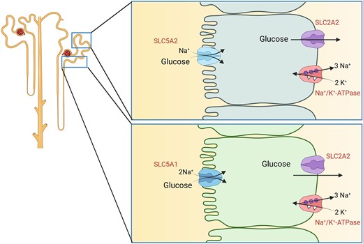 Renal glucose transport. Reabsorption of glucose by SGLT2 (SLC5A2) transporters in early proximal tubule (upper cell model) and SGLT1 (SLC5A1) in late proximal tubule (lower cell model). In both cell types, transport is energized by Na+/K+-ATPases. Glucose exits cells via GLUT2 (SLC2A2) transporters.