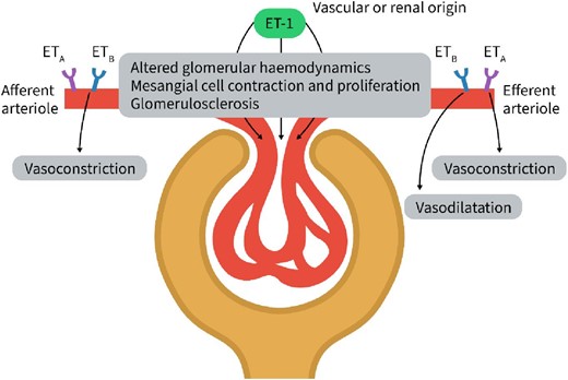 ETA and ETB receptors are present in the afferent and efferent arteriole. ETA and ETB antagonism is required to diminish the vasoconstrictive effects of ET-1 in the afferent arteriole indicating that both ETA and ETB activation modulate the vasoconstrictive effects of ET-1. In the efferent arteriole, ETA inhibition causes vasodilatation. Inhibition of the ETB receptor counteracts this effects and results in vasoconstriction. This indicates that in the efferent arteriole binding of ET-1 to ETA results in vasoconstriction and binding to ETB in vasodilatation. Renal blood flow is thus regulated by ET-1 through its effects on ETA and ETB in the afferent and efferent arteriole. The figure was adapted from Dhaun et al., Nature Reviews Cardiology 2019:16:491–502.