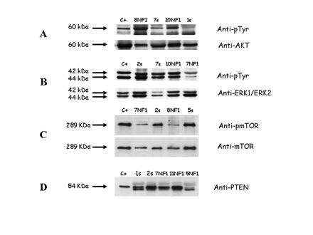 PTEN, AKT, ERK, and mTOR biochemical analysis. (A) Membrane incubation with phosphorylated Akt Ser 473 and anti-Akt polyclonal antibodies revealed a 60-kDa band corresponding to the activated (upper arrow) and expressed (lower arrow) Akt form. The samples showed phosphorylation levels similar to (NF1-related case 10 [10NF1]) or more (case 8NF1) or less (sporadic cases 7s and 1s) intense than 2N5A cells were used as positive controls. (B) Membrane incubation with both phosphorylated ERK and anti-ERK polyclonal antibodies revealed two bands of 42 and 44 kDa, corresponding to the ERK1 and ERK2 activated (upper arrow) and expressed (lower arrow) forms, respectively. ERK1 and ERK2 phosphorylation levels were similar to (cases 2s, 7s, and 10NF1) or less intense (case 7NF1) than those observed in the 2N5A cells used as positive controls. (C) Membrane incubation with phosphorylated mTOR and anti-mTOR polyclonal antibodies revealed a 289-kDa band corresponding to the activated (upper arrow) and expressed (lower arrow) mTOR form. Phosphorylation levels were similar to (cases 2s and 5s) or less intense (cases 7NF1 and 8NF1) than those observed in A431 cells used as positive control. (D) Membrane incubation with PTEN antibody revealed a 54-kDa band in all cases (cases 1s, 2s, 7NF1, and 11NF1) except in one case (case 5NF1) that showed reduced PTEN expression compared to A431 cell line used as positive control. C+, positive control.
