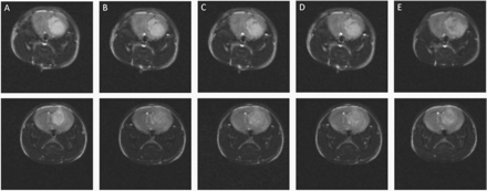 In vivo T2-weighted MRI of a CD-1 nude brain tumor mouse model. (A) Before, (B) 10 min, (C) 1 h, (D) 2 h, and (E) 24 h post-injection of the targeted (top row) and nontargeted (bottom row) superparamagnetic Fe3O4 nanoparticles. A spin echo pulse sequence with the following parameters was used: TR = 5000 ms, TE = 60 ms, FOV = 2 × 2 cm, matrix size 128 × 128, and slice thickness of 1 mm.