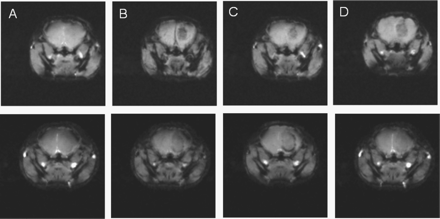 In vivo  MRI of a CD-1 nude brain tumor mouse model. (A) Before, (B) 20 min, (C) 1 h, and (D) 24 h postinjection of targeted (top row) and nontargeted (bottom row) superparamagnetic Fe3O4 nanoparticles. A gradient echo flow compensation method was used with the following parameters: FOV = 2 × 2 cm, slice thickness 1 mm, TR = 50 ms, TE = 7 ms, 50 kHz bandwidth, 15 degree flip angle and matrix size 128 × 128.