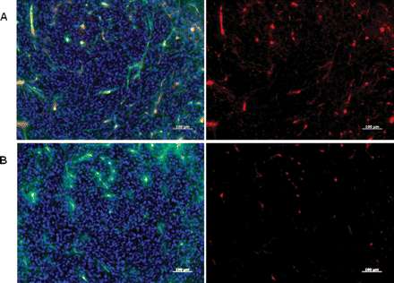 Fluorescent microscopic images of mouse glioblastoma multiforme tumor sections obtained 24 h after intravenous injection of anti-IGFBP7 single domain antibody-targeted (A) or nontargeted (B) iron oxide NPs-Cy5.5 (red). Images reveal the strong association of the targeted NP to tumor vessels compared to the nontargeted NP. Mice were also injected with 40 µg of FITC-labeled tomato lectin 10 minutes before sacrifice to stain blood vessels in vivo. Lectin staining (green) co-localizes with the NP-Cy5.5 signal (red) in overlay images to produce yellow-orange. Cell nuclei are stained with DAPI (blue). Scale bar: 100 μm.