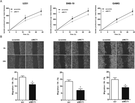 Effect of MCT1 downregulation on lactate production and cell migration. (A) Lactate production decreased at 12 and 24 h in both siMCT1 U251 and SNB-19 cells and only at 24 h in GAMG cells. Results represent the mean ± SD of at least 3 independent experiments, each in triplicate. *P ≤ .05, siMCT1 cells compared with scramble. (B) Downregulation of MCT1 decreased the migration capacity of cells by the wound-healing assay. Results represent the mean ± SD of at least 3 independent experiments. *P ≤ .05, siMCT1 cells compared with scramble.