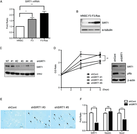 SIRT1 expression level was increased in F3.Ras.CNSCs (F3.Ras), and SIRT1 knockdown caused growth retardation in F3.NSCs. (A) The mRNA level of SIRT1 in human fetal NSC (hfNSC), F3.NSCs (F3), and F3.Ras.CNSCs (F3-Ras) was determined via real-time PCR (n = 3). (B) SIRT1 levels were determined via immunoblotting. (C) The lentiviral shRNA SIRT1 infection in F3.NSCs was confirmed by immunoblotting for SIRT1. ERK2, extracellular signal-regulated kinase 2. (D) ShCont (closed circle) and shSIRT1 #1, #3, and #5 (open circle, square, and triangle, respectively)–infected F3.NSCs were plated at 2 × 103 cells. Optical density (OD) ratio was measured using XTT every 2 days (left panel) (n = 3). The phospho-Rb levels were determined via immunoblotting in F3.NSCs infected with shCont and shSIRT1. (E) ShCont and shSIRT #3 or #5–infected F3.NSCs were analyzed by SA-β-gal staining assay (scale bars, 200 m). Black arrow for β-gal–positive senescent cell. (F) The mRNA level of SIRT1, Sox2, and nestin in shCont and shSIRT1 F3.NSCs was determined via real-time PCR (n = 3). Alpha-tubulin, β-actin, or ERK2 was a loading control.