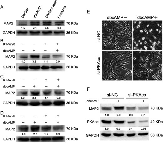 Positive modulation of low-molecular-weight MAP2 by PKA activation. (A) C6 glioma cells were seeded at a density of 5 × 105, incubated with PKA activators (1 mM dbcAMP, 10 ng/mL cholera toxin, and 30 μM forskolin) for 48 hours, and Western blotting was then used to evaluate the protein level of low-molecular-weight MAP2. C6 (B), DBTRG-05MG (C), and A172 (D) cells were seeded at a density of 5 × 105, pretreated with 2 μM of PKA inhibitor KT-5720 for 2 hours before 1 mM dbcAMP treatment for an additional 48 hours to evaluate the protein level of MAP2. C6 glioma cells were seeded at a density of 5 × 104, transfected with 50 nM si-PKAcα oligonucleotides for 24 hours, and then treated with or without 1 mM dbcAMP for an additional 48 hours to evaluate the morphological alterations (E) and MAP2 expression (F) (original magnification: × 200; scale bar: 100 μm). Antibodies were purchased from Cell Signaling Technology (#4542, #8707, #4782).